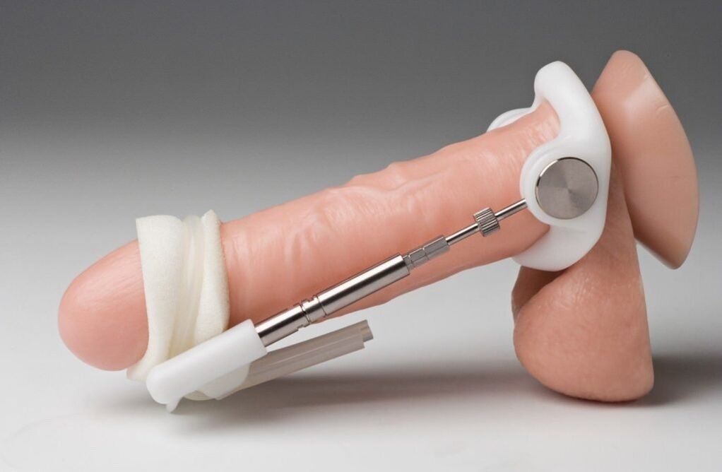 Extensor para aumentar o grosor do pene